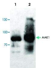 PAB8529 - Méret : 100 mikrogramm - Anti-AAK1 Nyúl Poliklonális Antitest - Minden (100micrograms)